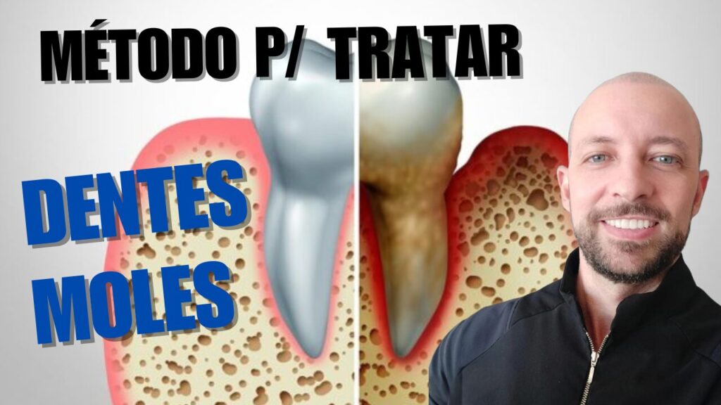 dentes moles